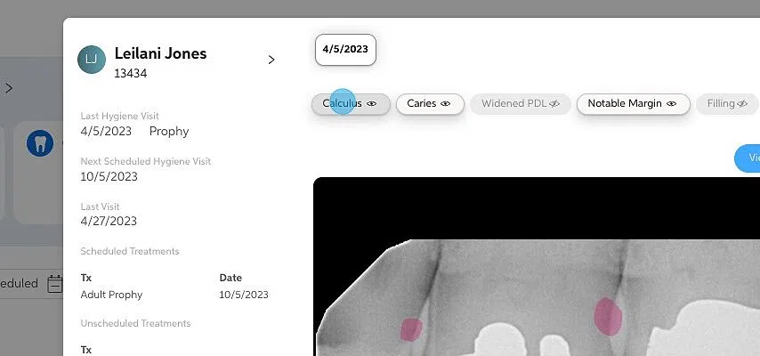 Screenshot of: In the patient module you can see the radiographs taken for the patient. Along the left-hand side you can see their last hygiene visit, their next scheduled hygiene visit, any scheduled treatments, and any unscheduled treatments. Across the top of the module you can turn detections on and off by clicking on them.