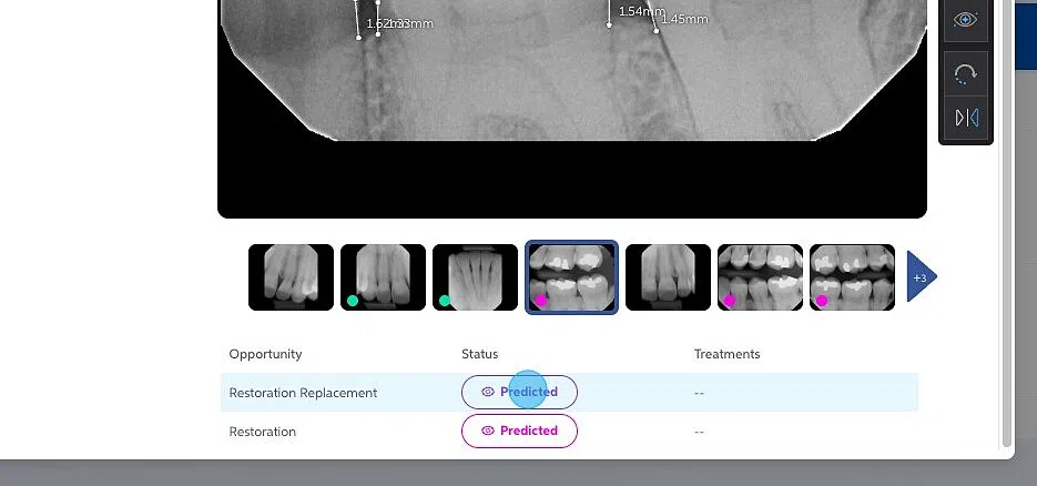 Screenshot of: At the bottom of the patient module you will see all of the patient radiographs as well as all predictions found in that series. Clicking on the predictions will bring up those images.